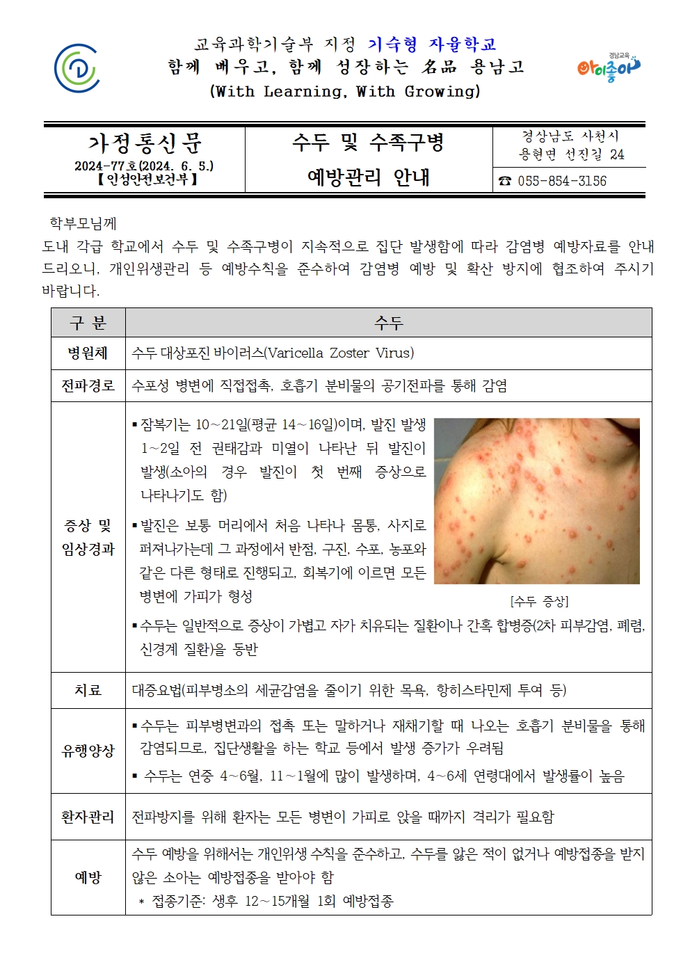 수두 및 수족구병 예방관리 안내001.jpg